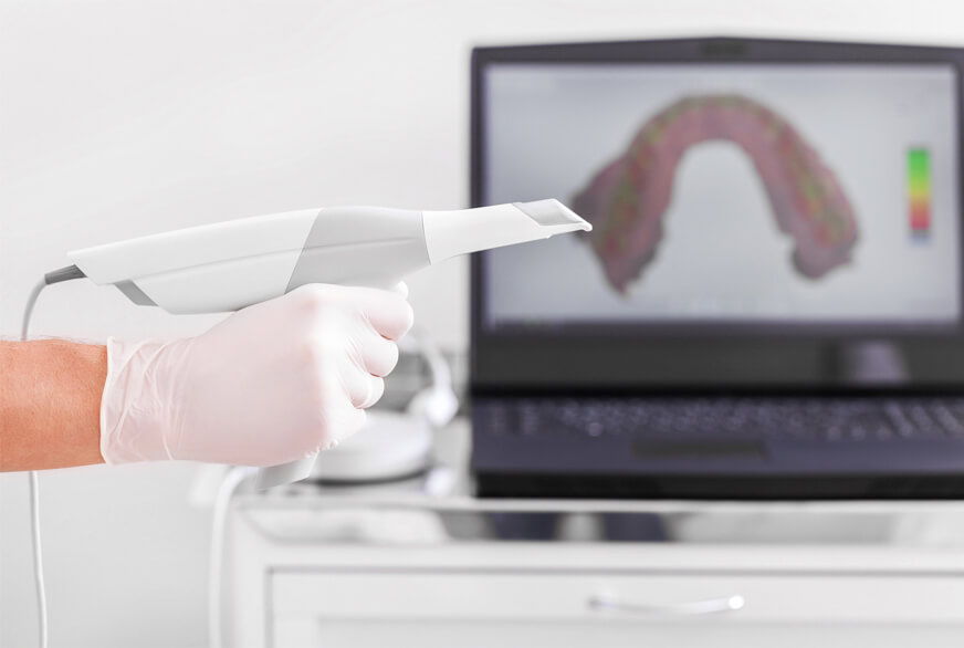 Ortodoncia invisible - Vibart Dental Clinic